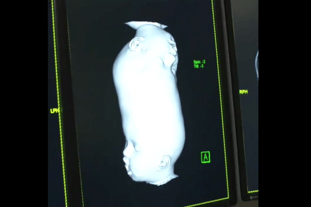 medical 3d scan virtual reality